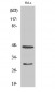 Cathepsin D Polyclonal Antibody